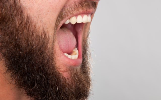 Bearded men carry more germs than dogs